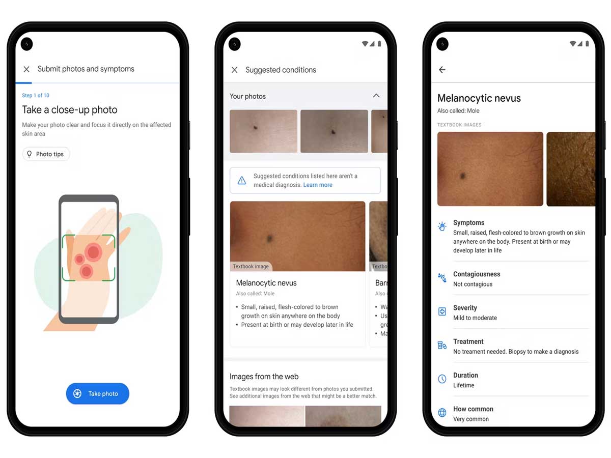 Google Lens can now search for skin conditions