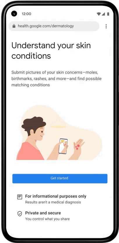 Using AI to help find answers to common skin conditions